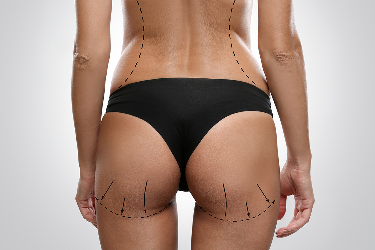 UltraSculpt Bella Body Yardley PA