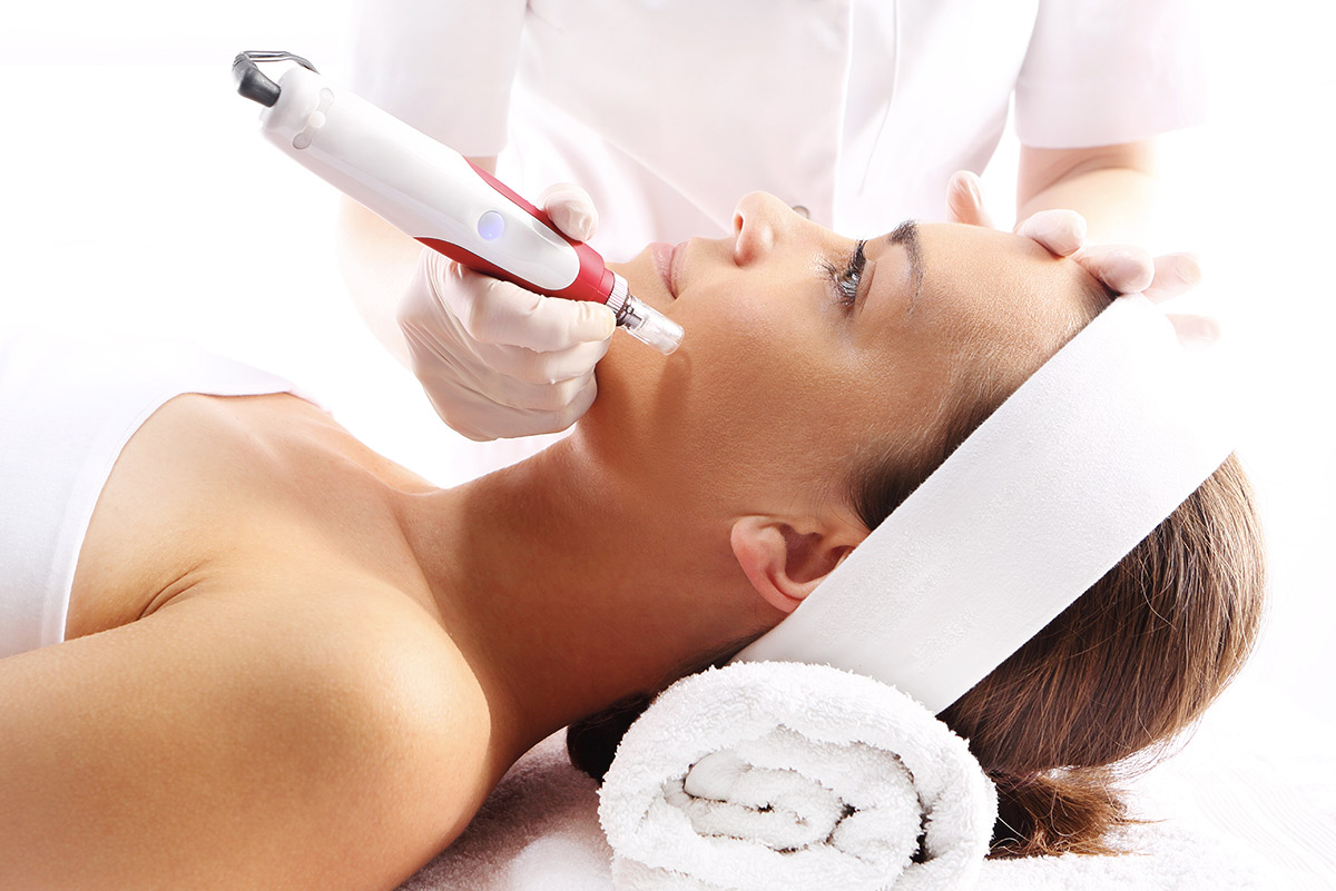 Microneedling