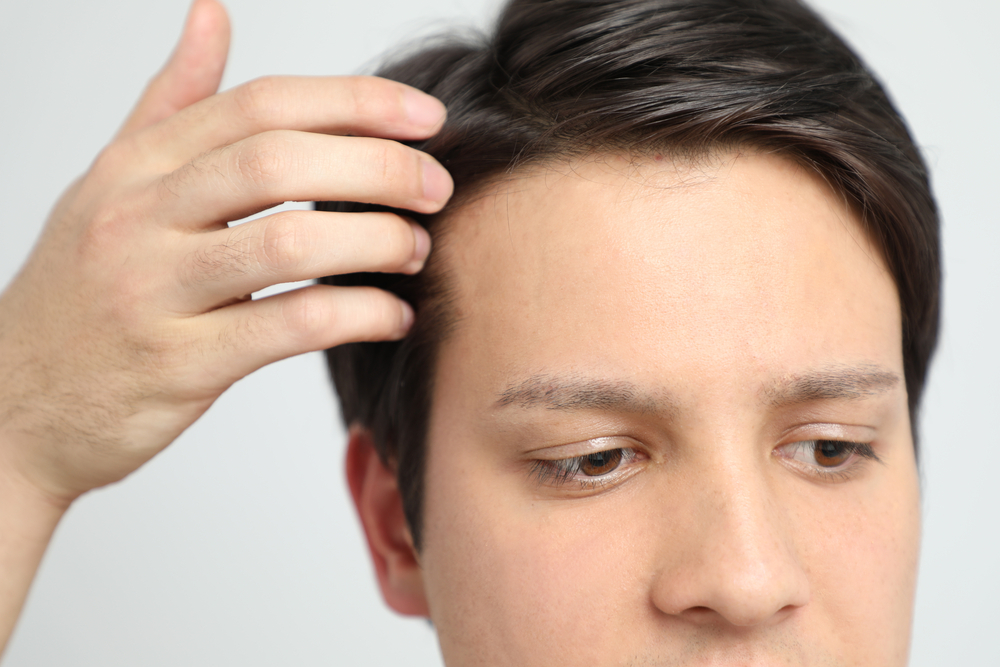 PRF-for-Hair-Restoration
